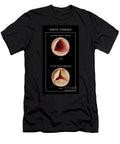 1 Aortic Valve Normal Stenosis Monica Schroeder T-Shirt