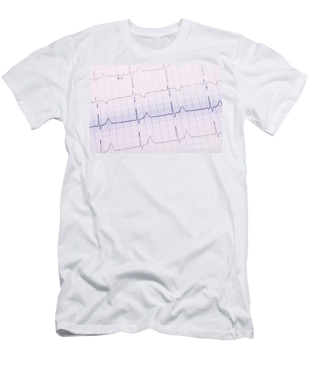 2 Healthy Electrocardiogram Giphotostock T-Shirt