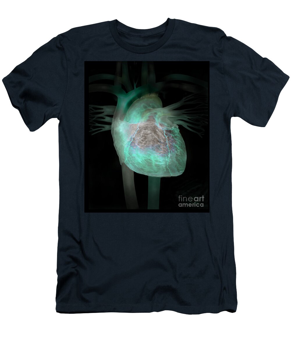 Human Heart Illustration Jim Dowdalls T-Shirt